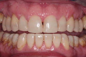 smile design after 7