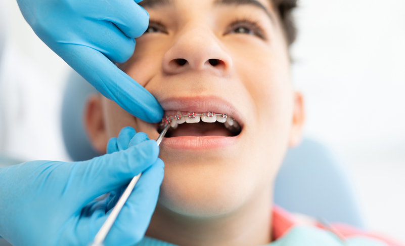 Orthodontic Treatment at Highgate Dental Practice